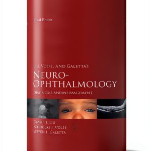 Ophthalmology 3rd Edition Kindle eBook Elsevier 699 Pages-0